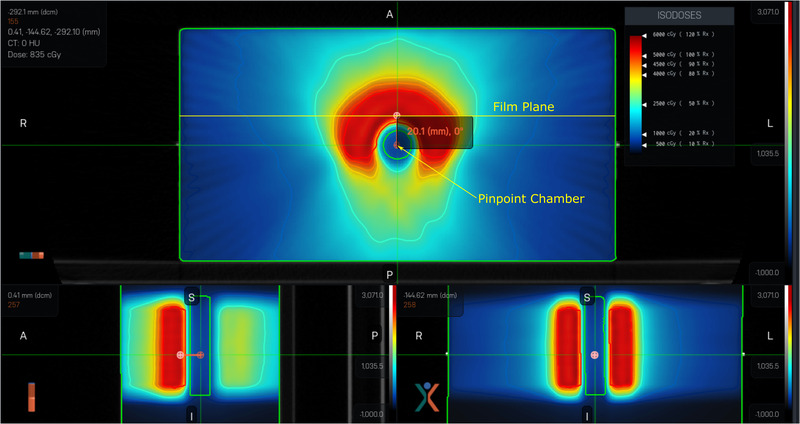 FIGURE 3