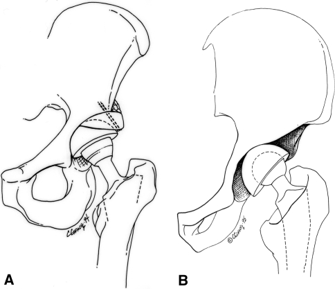 Fig. 1A–B