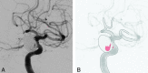 Fig 6.
