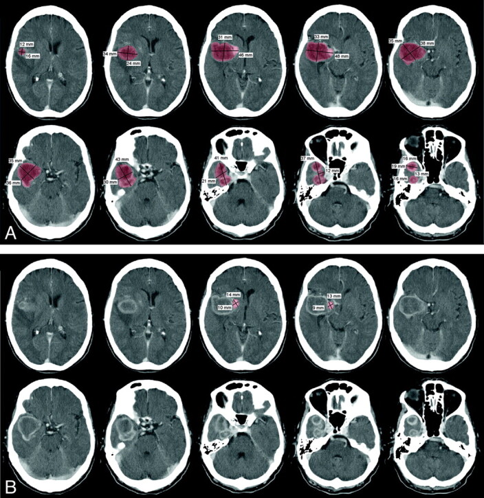 Fig 2.