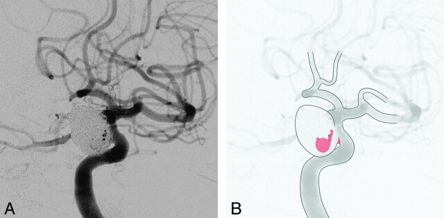 Fig 6.