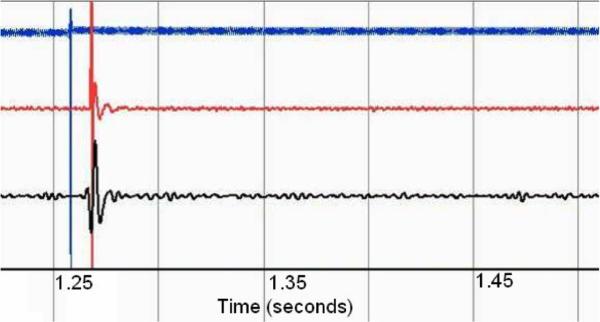 Fig. 14