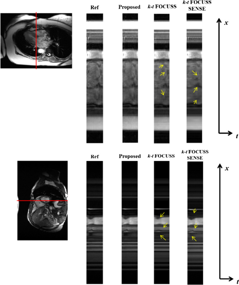 Fig. 8