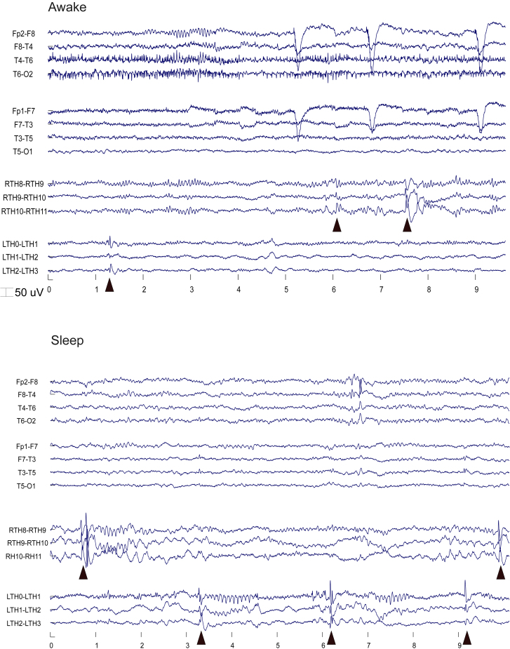 Figure 3