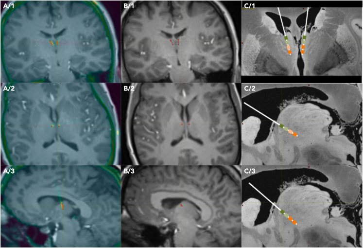 Figure 2