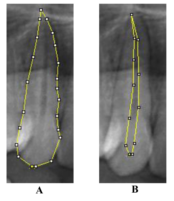 Fig. (1)