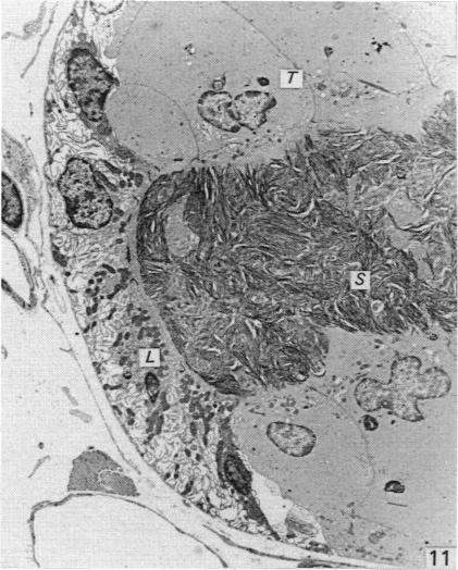 Fig. 11