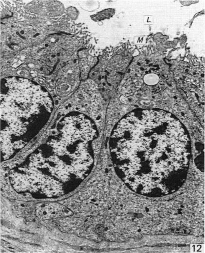 Fig. 12