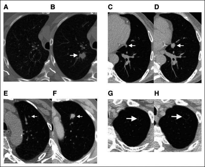 FIG 3.