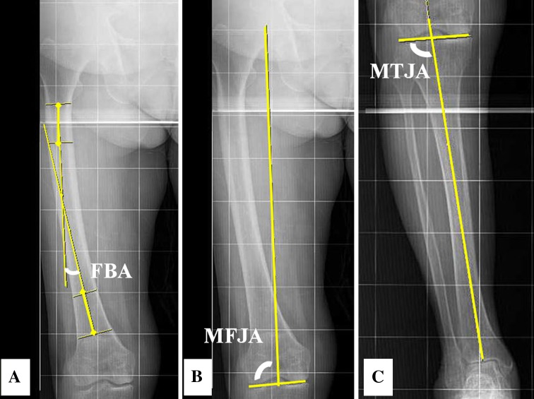 Fig. 1A–C