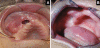 Fig. 3