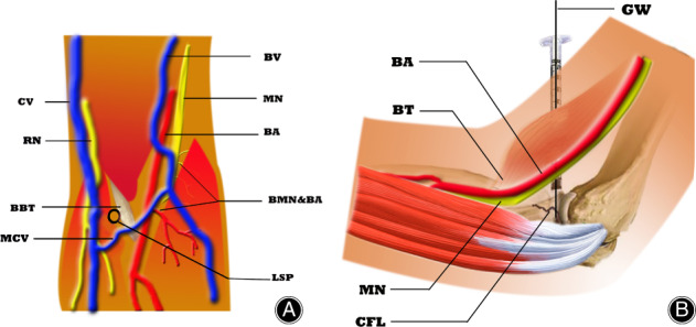 Fig. 2