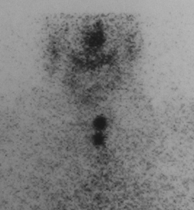 FIG. 1.