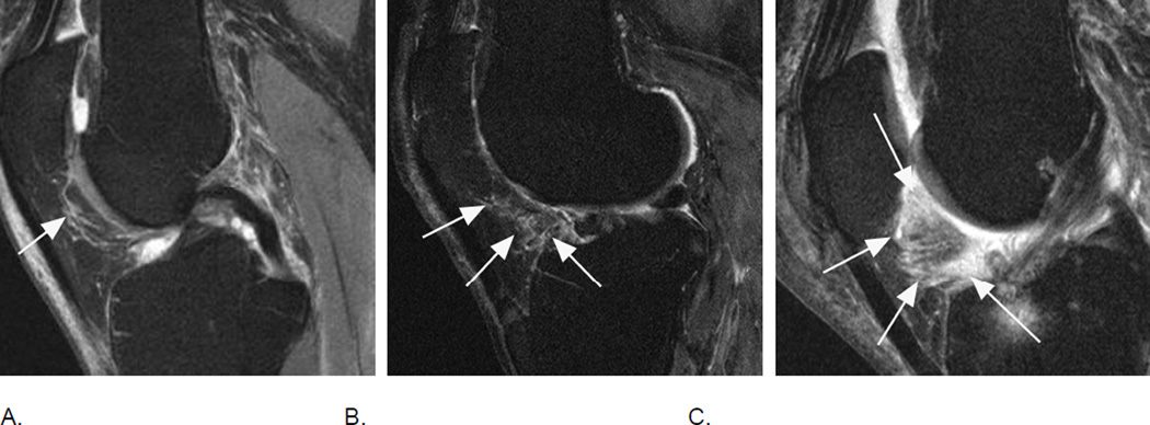 Figure 19