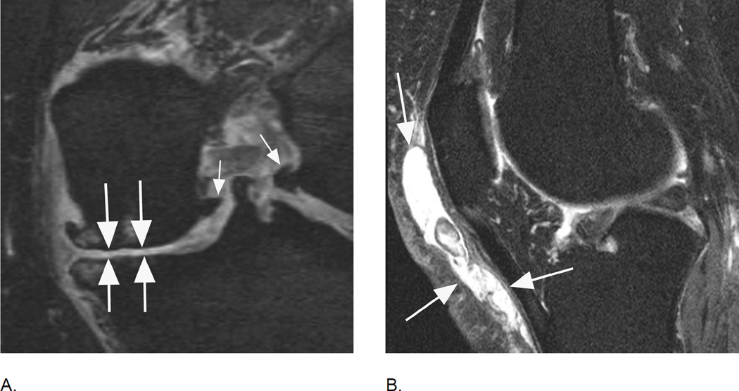 Figure 23