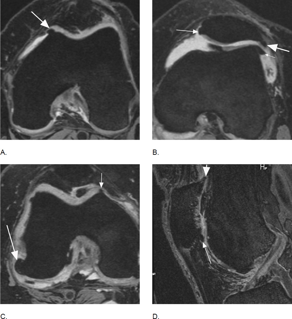 Figure 22