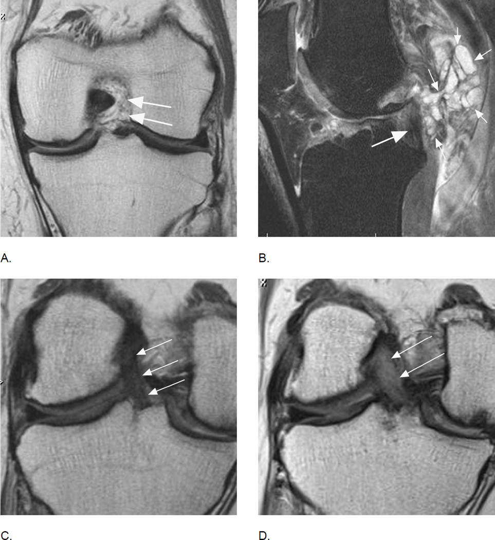 Figure 25