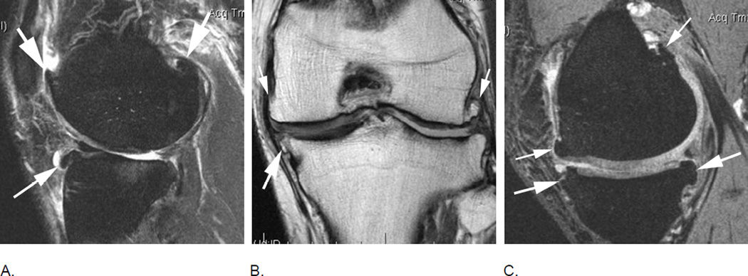 Figure 21