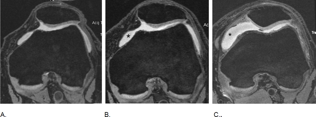 Figure 18