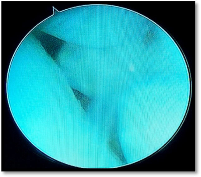 Fig. 6