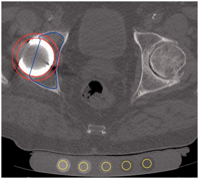 Fig. 2.