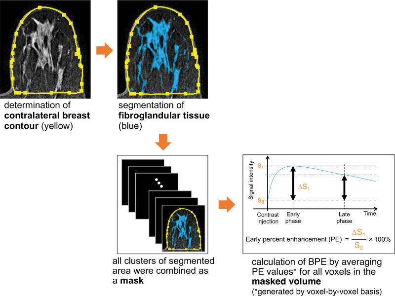 Fully automated background parenchymal enhancement (BPE) measurement. S0 = signal intensity at contrast-unenhanced phase, S1 = signal intensity at early contrast-enhanced phase, ∆S1 = S1 − S0.