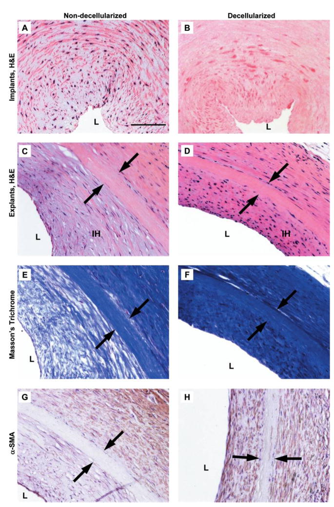 FIG. 9