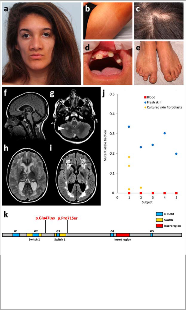 Figure 1 |