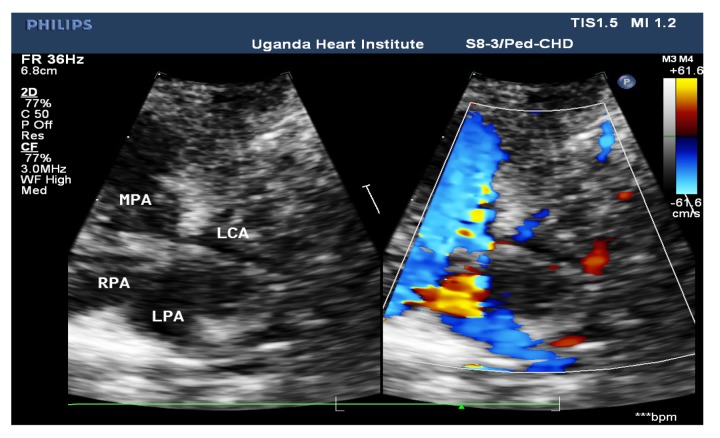 Figure 3b