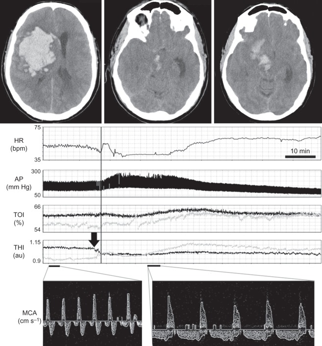 Fig 1