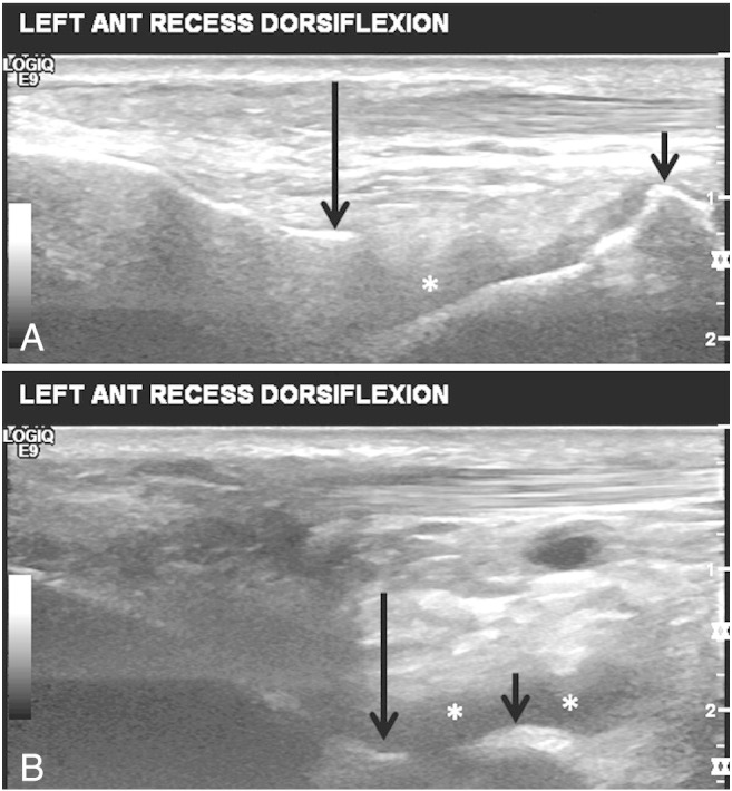 Fig 2