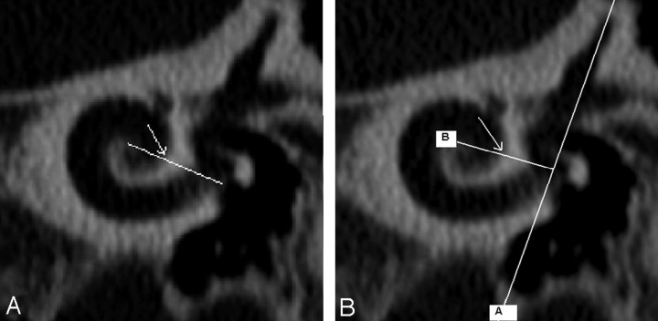 Fig 4.