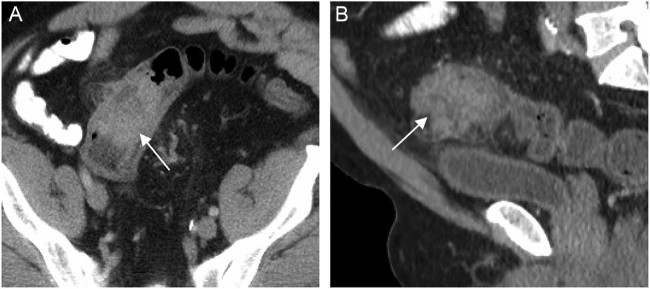 Fig. 2