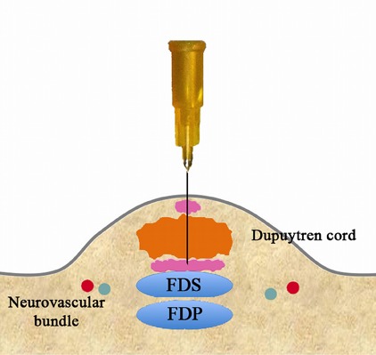 Fig. 3-C