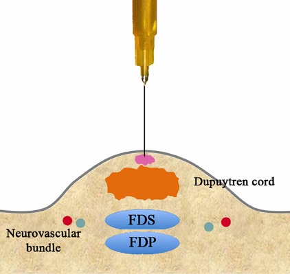 Fig. 3-A