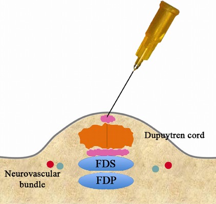 Fig. 3-F