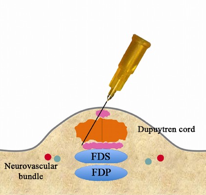 Fig. 3-G