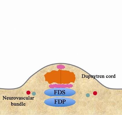 Fig. 3-B