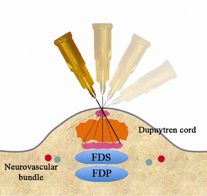 Fig. 3-I