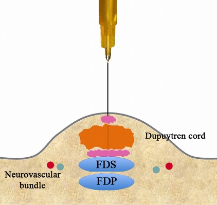 Fig. 3-D