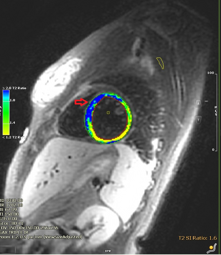 Fig. 3