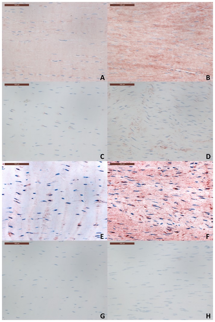 Fig 11