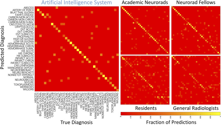 Confusion matrices for the artificial intelligence system and radiologists. Confusion matrices for different radiologist specialization levels were generated for the top diagnosis, averaged across individuals within each group. True disease labels are shown along the x-axis and predicted diagnoses on the y-axis. The color of each cell represents the fraction of cases within a column where the top predicted diagnosis matched the true diagnosis. Artery of Perch = artery of Percheron, Bilat thal glioma = bilateral thalamic glioma, Carbon Mon Acute = carbon monoxide: acute, Carbon Mon Chronic = carbon monoxide: chronic, Carbon Mon Subacute = carbon monoxide: subacute, CNS = central nervous system, Creutzfeld Jacob = Creutzfeldt-Jakob disease, DVT = deep vein thrombosis, Hemorrhage Chron = hemorrhage: chronic, Hemorrhage Subac = hemorrhage: subacute, High GR = high grade, HIE = hypoxic-ischemic encephalopathy, Infarct Chron = infarct: chronic, Low GR = low grade, Neuro Behcets = neuro Behçet disease, Neurofibromat 1 = neurofibroma type 1, Neurorad fellows = neuroradiology fellows, Neurosarcoid = neurosarcoidosis, Nonketot hypergly = nonketotic hyperglycemia, Wernickes = Wernicke encephalopathy, Wilsons = Wilson disease.