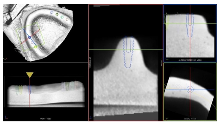 Figure 1