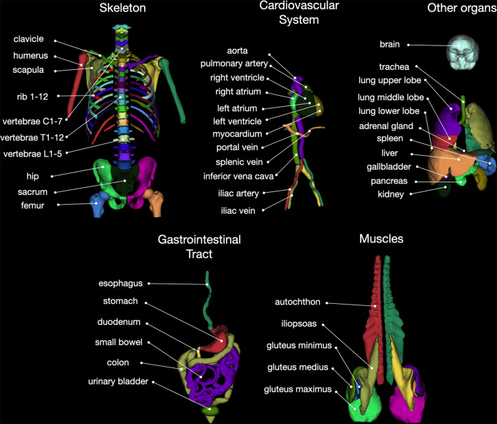 Overview of all 104 anatomic structures segmented by the TotalSegmentator. autochthon = autochthonous dorsal musculature.