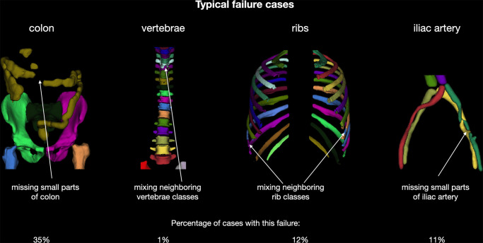 Overview of typical failure cases of the proposed model. Users should be aware that these problems may occur.