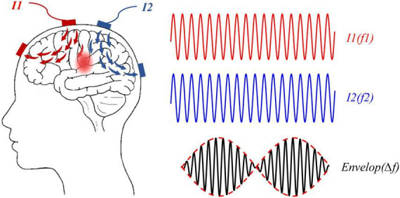 FIGURE 1