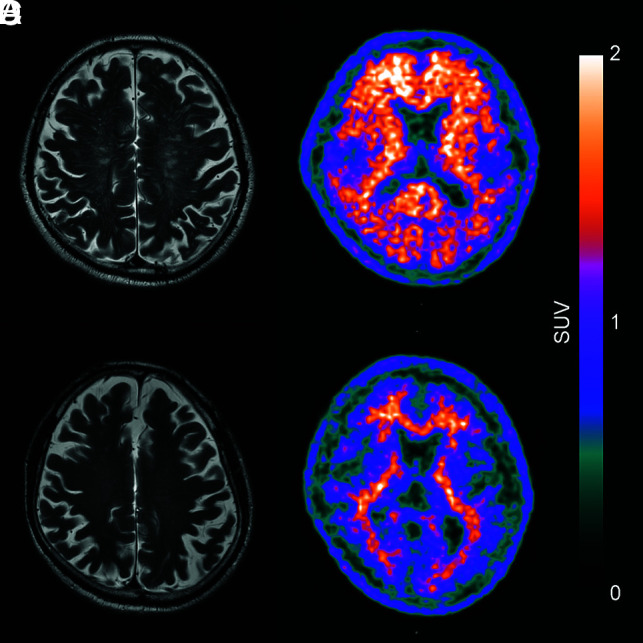 FIG 3.