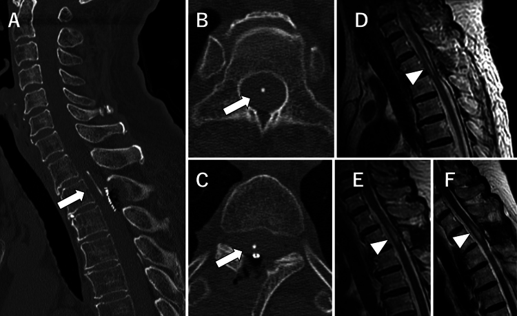 FIG. 5.