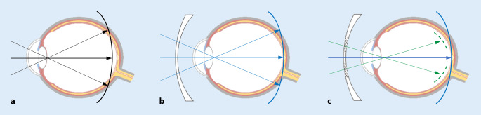 graphic file with name 347_2021_1452_Fig1_HTML.jpg